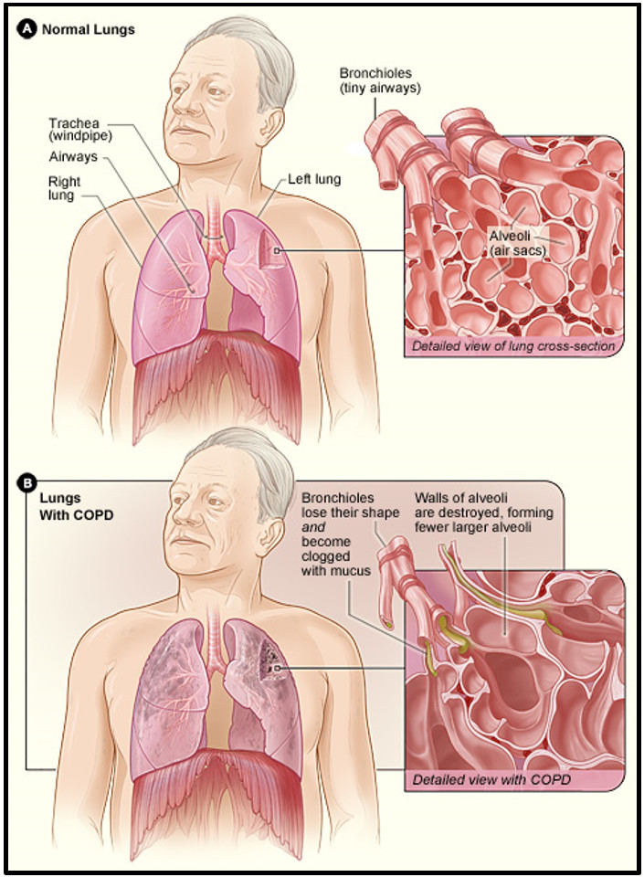 images of lungs in human body