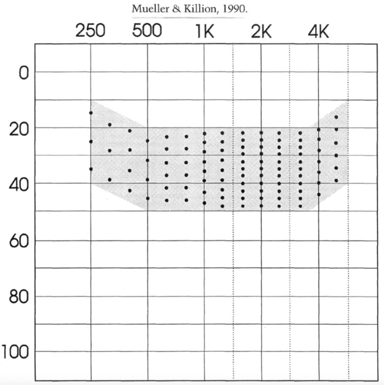 Speech Intelligibility Index Chart